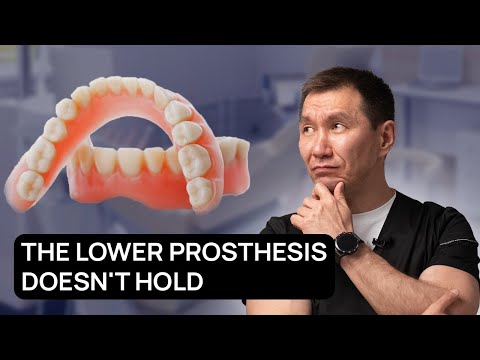 THE LOWER FULL DENTURE DOESN'T HOLD! What can I do to make it hold?