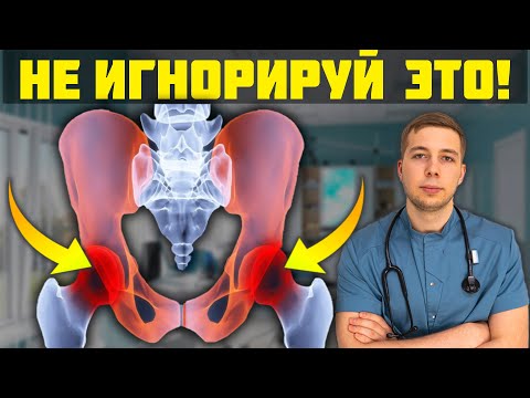 Болит ТАЗОБЕДРЕННЫЙ СУСТАВ? Никогда не игнорируйте ЭТИ УПРАЖНЕНИЯ!