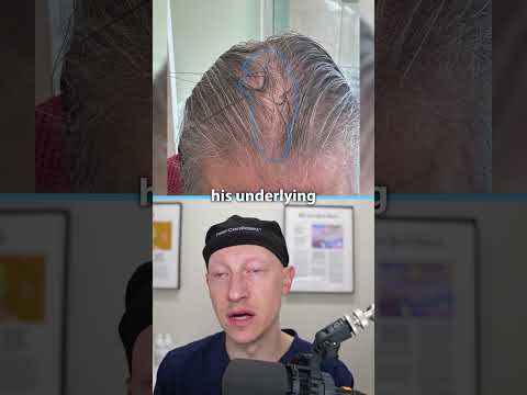 Underlying Medical Conditions CAN Cause Hair Loss
