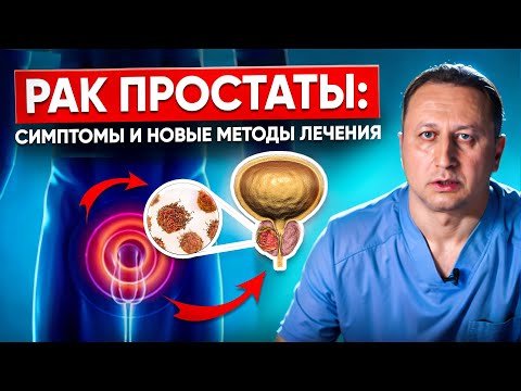 Рак предстательной железы.  Симптомы рака простаты, методы лечения и профилактика рака простаты.