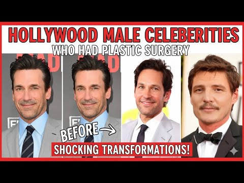 Hollywood Male Celebrities Who Had Plastic Surgery  | Hollywood’s Best-Kept Secret