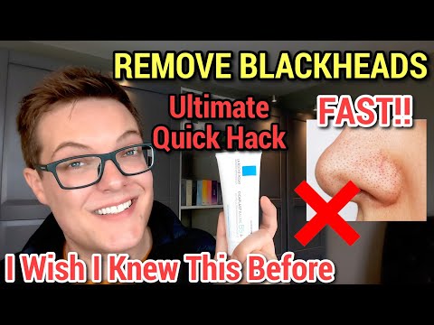 REMOVE SEBACEOUS FILAMENTS FAST - Blackhead Removal With La Roche-Posay Cicaplast Baume