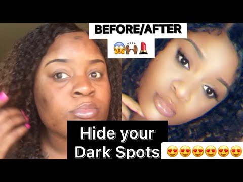 #How to cover up DARK SPOTS with makeup😱💄