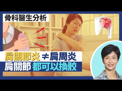 肩關節炎｜肩周炎五十肩≠肩關節炎 關節囊炎症vs關節發炎！退化性關節炎 軟骨磨蝕令骨頭增生形成骨刺！肩關節都可以換骹 類風濕關節炎、骨折患者較常見｜王建芳醫生 骨科醫生文浩然醫生｜人類健康研究所