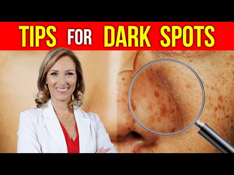 Tips for Dark Spots & Hyperpigmentation | Dr. Janine