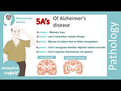 5As of Alzheimer's disease | USMLE mnemonic series