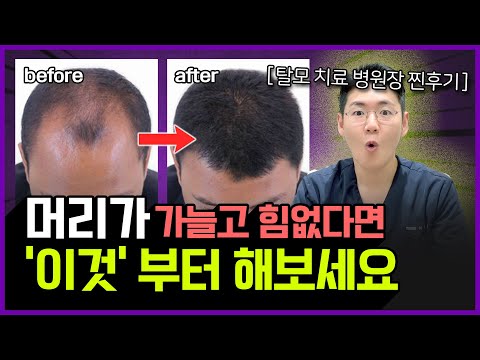 머리가 가늘어지는 이유 & 머리카락이 굵어지는 가장 확실한 방법