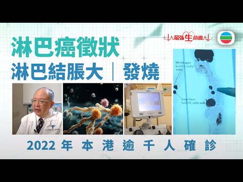最強生命線｜淋巴癌早期徵狀不明顯　常見病徵：淋巴結脹大、發燒、夜汗（繁 / 簡字幕）｜醫療｜治療｜無綫新聞｜TVB News