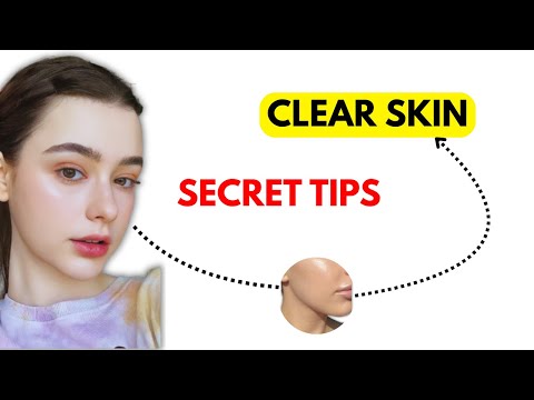 Get CLEAR Skin FAST: No-Nonsense Hacks That WORK!  (Proven Tips)