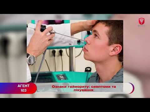 Ознаки гаймориту: симптоми та лікування - поради вінницького медика