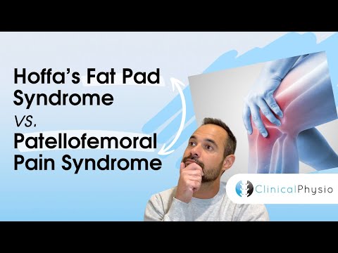 Hoffa’s Fat Pad Syndrome vs. Patellofemoral Pain | Expert Physio Guide