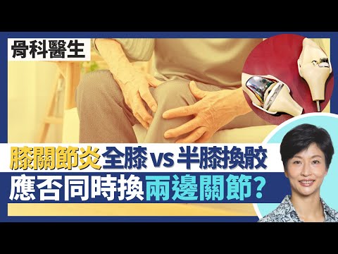 膝關節炎（下）｜人工關節換骹手術詳談 全膝vs半膝關節置換！兩邊關節應否同時換 術後即日可落地甚至自己行出手術室？退化性關節炎=香港第3大長者常見慢性病｜王建芳醫生 骨科醫生張文康醫生｜人類健康研究所