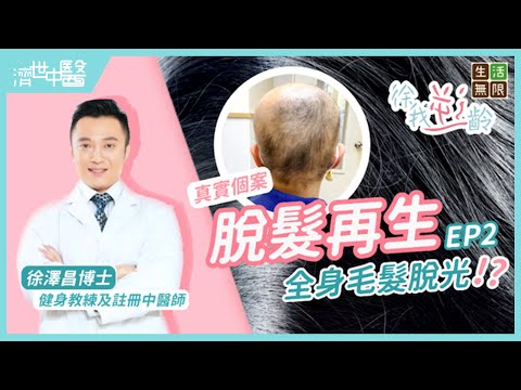 脫髮再生由根開始｜真實個案 全身毛髮脫光｜中醫分享黑芝麻烏髮效果｜頭皮按摩｜#徐我逆齡(第2集) #濟世中醫 #徐澤昌 #脫髮治療 #脫髮原因 #脫髮食療 #防脫髮洗頭水 #頭髮再生 #禿頭 #生髮水