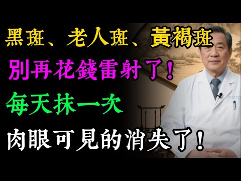 臉上、手上的黑斑、老人斑,別再花錢雷射了!72歲醫師的10個「天然淡斑」秘方,不花錢,效果驚人!#健康知識 #老年健康#老人斑 #黑斑 #雀斑 #皮膚保養 #天然保養 #抗老化 #醫師健康日記