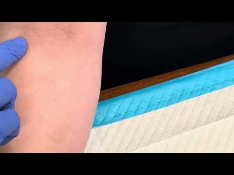 3 Tips For Locating DIFFICULT Veins | Phlebotomy Tip | Medical Assistant Training