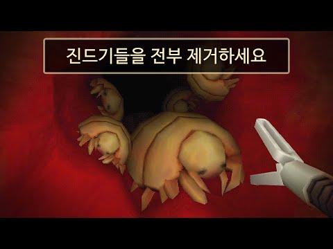 대장 내시경으로 환자들의 대장을 확인하는 게임 (Revenge Of The Colon)