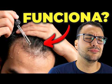 COMO REALMENTE ACABAR com a QUEDA DE CABELO (de acordo com a ciência)
