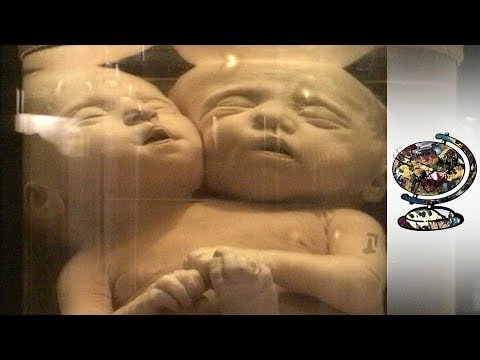 The Terrible Toll of Russia's Secret Nuclear Accident (2001)