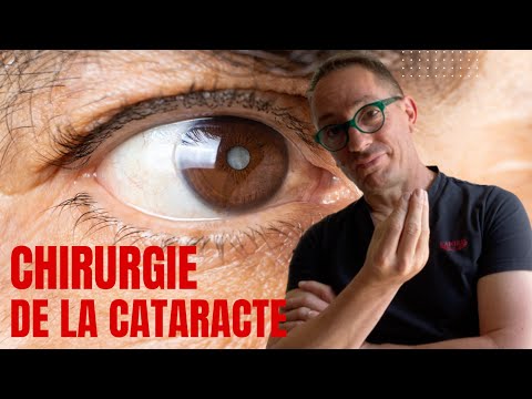La chirurgie de la Cataracte: Les vérités à connaître avant de vous faire opérer !