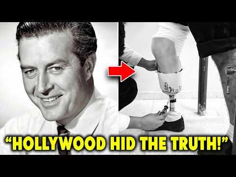 Golden Age Stars Who Secretly Hid Deformities and Disabilities