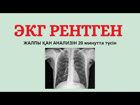 🆘ЭКГ ОСЫНДАЙ ОҢАЙ МА?  🤯