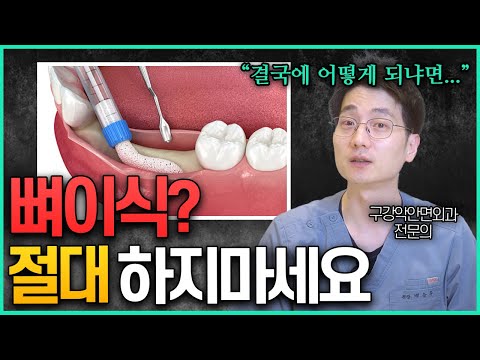 "뼈이식 권하면 이렇게 말하세요" 임플란트 사기 안당하는 방법