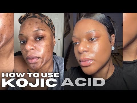 HOW TO USE KOJIC ACID SOAP *WATCH THIS BEFORE USING KOJIC ACID*