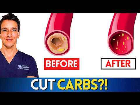 Can you Unclog your Arteries by Cutting Carbs?!?