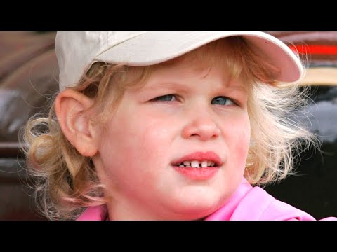 Lady Louise Windsor Was Born With A Rare Health Condition