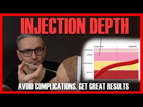 NEEDLE DEPTH: How to choose best depth to avoid complications & get results [Aesthetic Mastery Show]