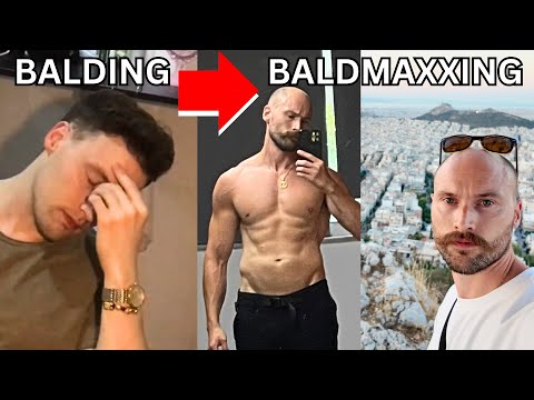 Balding Shattered My Confidence – BALDMAXXING Built It Back (My Mission)
