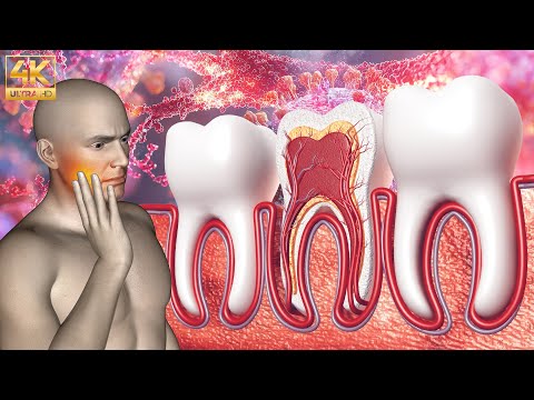 Tooth Decay, Gingivitis, Bad Breath Disappear - Alphawave 741Hz DENTAL REPAIR #1