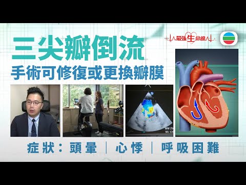 最強生命線｜三尖瓣倒流　手術與運動復康｜醫療｜治療｜無綫新聞｜TVB News