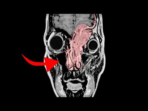 They had only a few days to figure out what this was