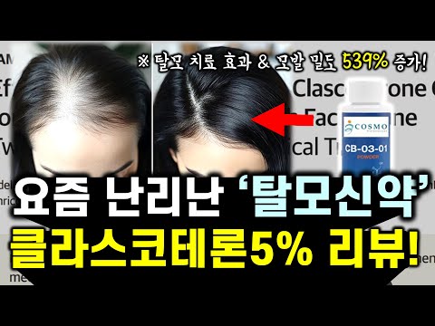 요즘 난리난 "탈모약 게임체인저" 클라스코테론 5% 리뷰 (feat. 효과, 부작용, 출시 일정, 가격)ㅣ탈모 치료 신약 리뷰