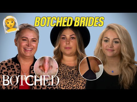 Botched Brides: Pulverized Noses, Extra Breasts and More?! (Before & After) | Botched | E!