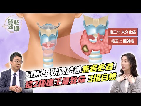 🧠50%的人有#甲狀腺結節！2大癌王最致命！⚡醫師教你3招自檢｜Thyroid Cancer Warning Signs｜【#醫點就通】EP50｜#緯來育樂台｜#王威迪 #陳潔雯 2025.09.10