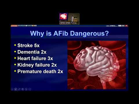 Beat Afib: Treatment and Latest Advancements