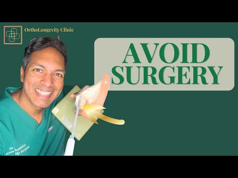 Meniscus Tears: What Actually Works (Surgeon’s 5-Step nonsurgical OrthoLongevity Plan)