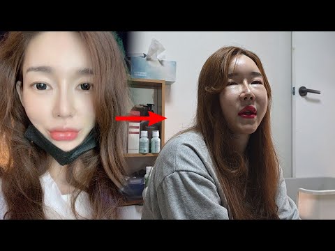 Transgender plastic surgery addict