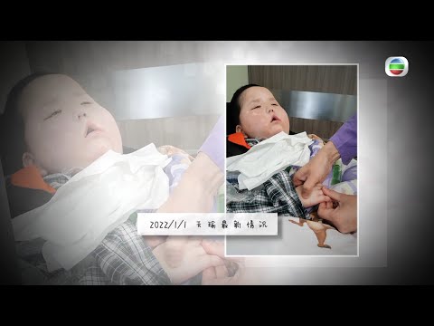 東張西望｜六歲植物人天瑜｜情況好轉｜聽見爸爸聲音｜眼睛轉動｜爸爸感動而泣