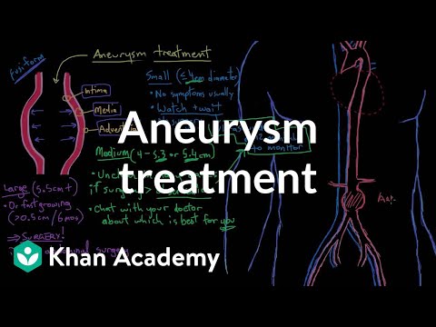 Aneurysm treatment | Circulatory System and Disease | NCLEX-RN | Khan Academy