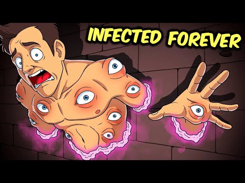 Parasitic SCPs That Will NEVER Leave You! (Compilation)