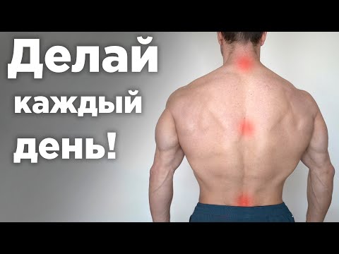 How to get rid of a HERNIA in the back WITHOUT SURGERY! Treatment with simple exercises