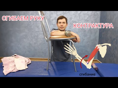 Не сгибается локоть после перелома - Лечение положением, укладки