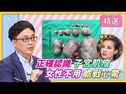正確認識"子宮肌瘤"！女性不用 膽戰心驚│《經典好節目》健康NO1_精選版(回顧系列)