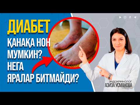 Diabetda non yeyish, parxez tutish, sport mumkinmi?