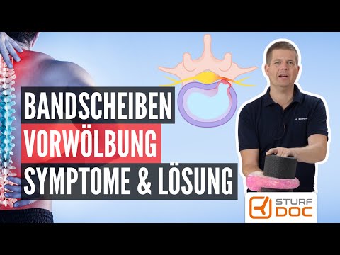 Symptome der Bandscheibenvorwölbung erkennen und Ursache abstellen !
