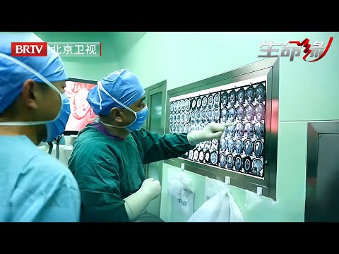 35岁护士一上夜班就头疼，忍了8年终于躺上手术台，眼前一幕医生头都大了，整个大脑表面都是瘤子【生命缘第12季】