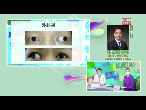 中大眼科 x 港台：成人斜視病因多 治療選項逐個講